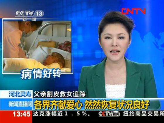 河北农民工割皮救女续:网友对友爱医院的质疑不正确
